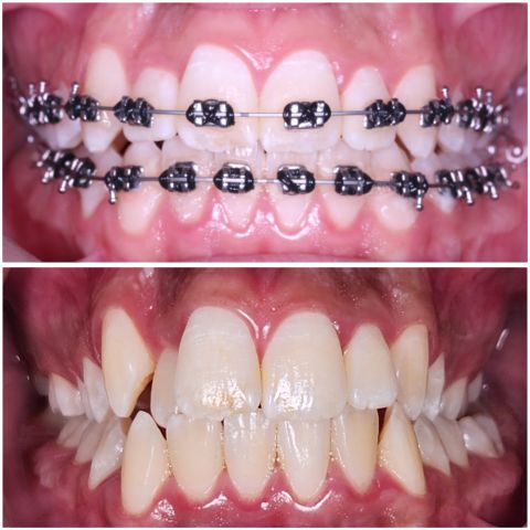 أخصائي تقويم أسنان ووجه